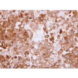 Immunohistochemistry - NQO1 antibody from Signalway Antibody (22937) - Antibodies.com