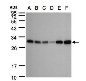 AK4 antibody from Signalway Antibody (22962) - Antibodies.com