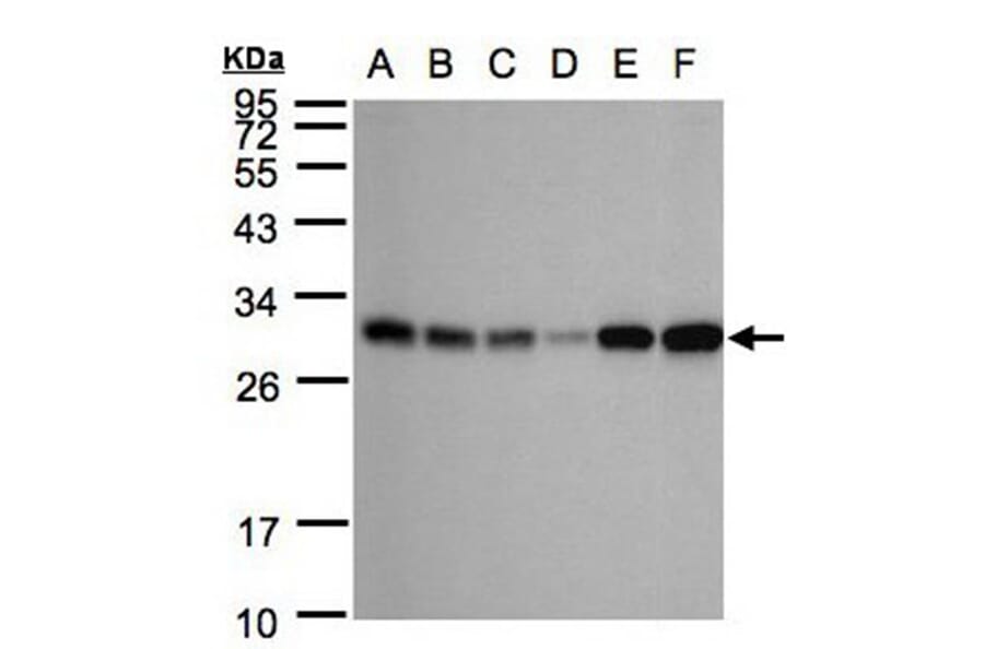 AK4 antibody from Signalway Antibody (22962) - Antibodies.com