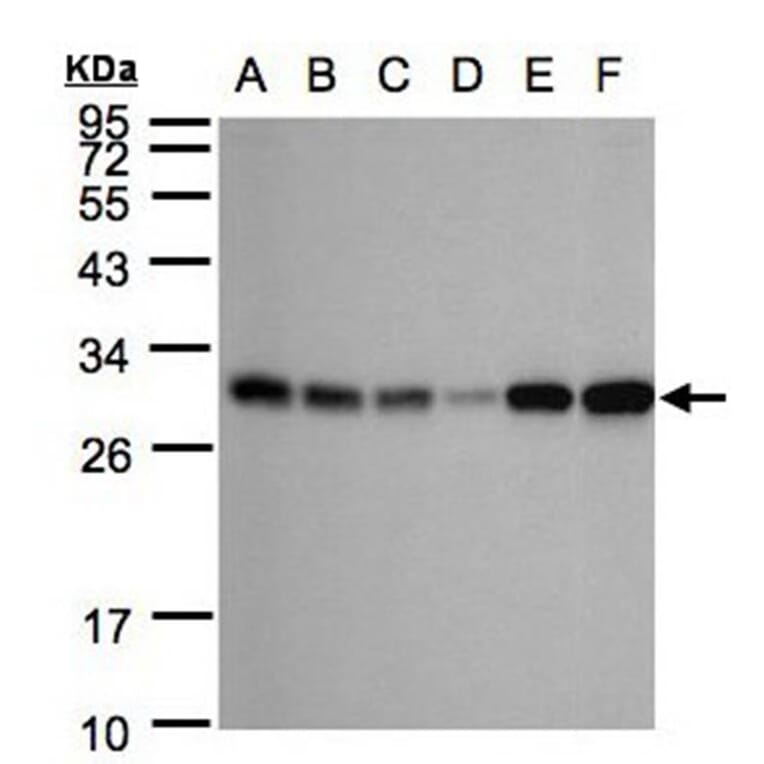 AK4 antibody from Signalway Antibody (22962) - Antibodies.com