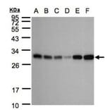 AK4 antibody from Signalway Antibody (22962) - Antibodies.com