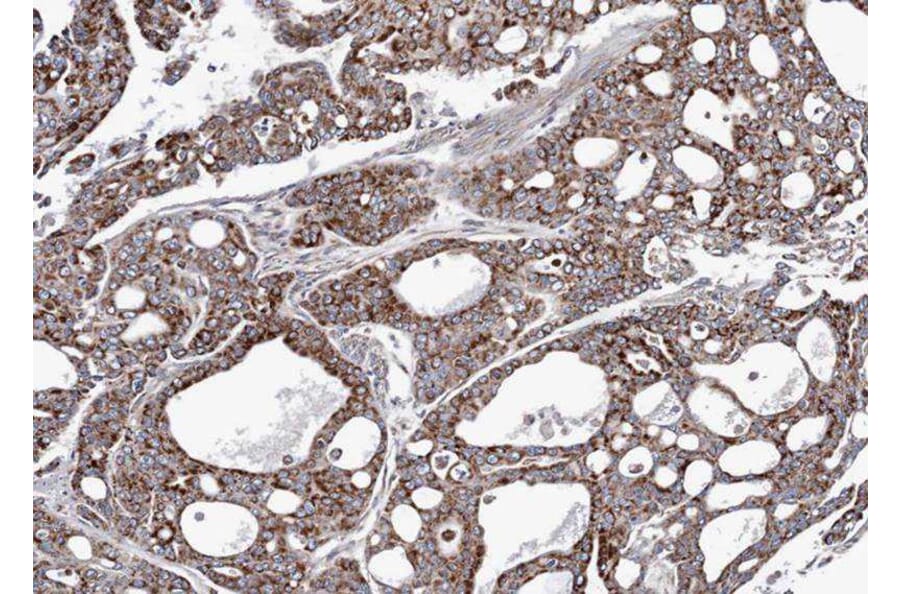 Immunohistochemistry - AK4 antibody from Signalway Antibody (22962) - Antibodies.com