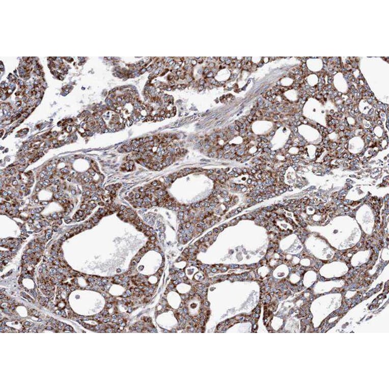 Immunohistochemistry - AK4 antibody from Signalway Antibody (22962) - Antibodies.com