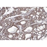 Immunohistochemistry - AK4 antibody from Signalway Antibody (22962) - Antibodies.com