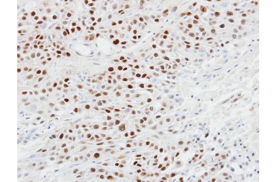 Immunohistochemistry - p63 antibody from Signalway Antibody (23089) - Antibodies.com