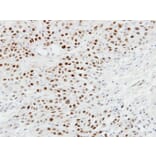 Immunohistochemistry - p63 antibody from Signalway Antibody (23089) - Antibodies.com