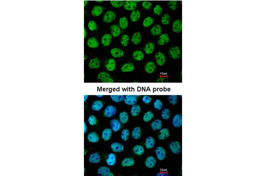 Immunofluorescence - p63 antibody from Signalway Antibody (23089) - Antibodies.com