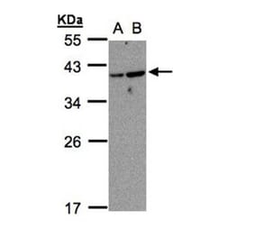 ARF7 antibody from Signalway Antibody (23152) - Antibodies.com