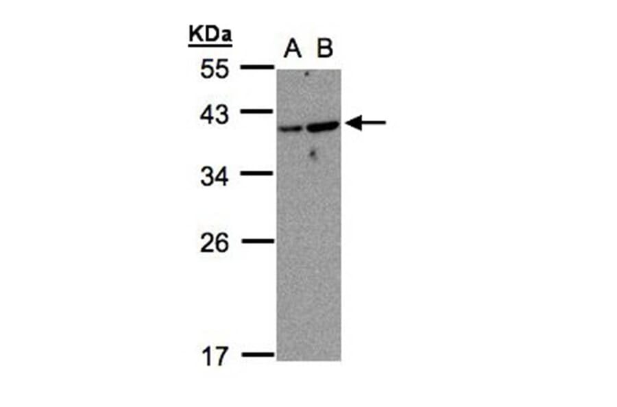 ARF7 antibody from Signalway Antibody (23152) - Antibodies.com