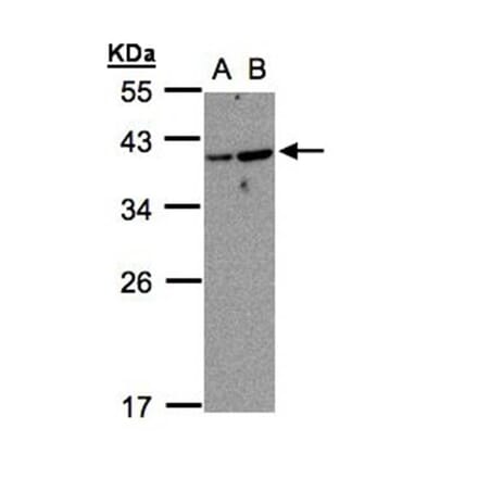 ARF7 antibody from Signalway Antibody (23152) - Antibodies.com