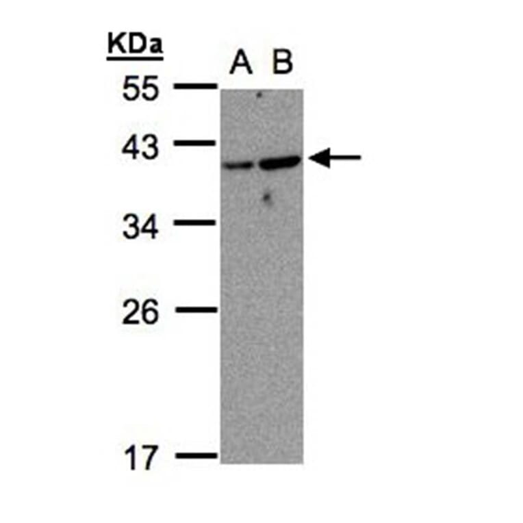ARF7 antibody from Signalway Antibody (23152) - Antibodies.com