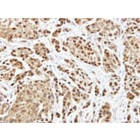 Immunohistochemistry - ARF7 antibody from Signalway Antibody (23152) - Antibodies.com