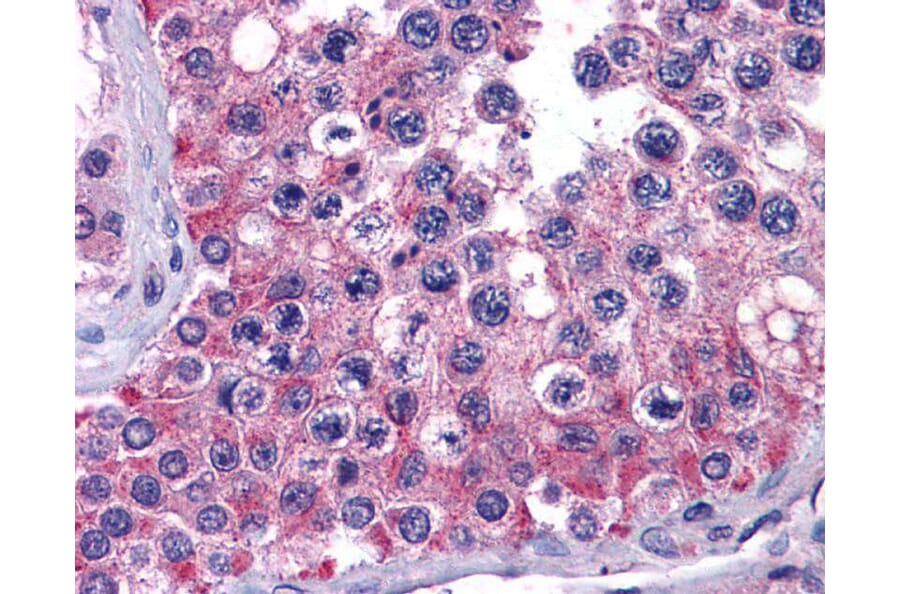 Immunohistochemistry - MIA3 antibody from Signalway Antibody (23183) - Antibodies.com