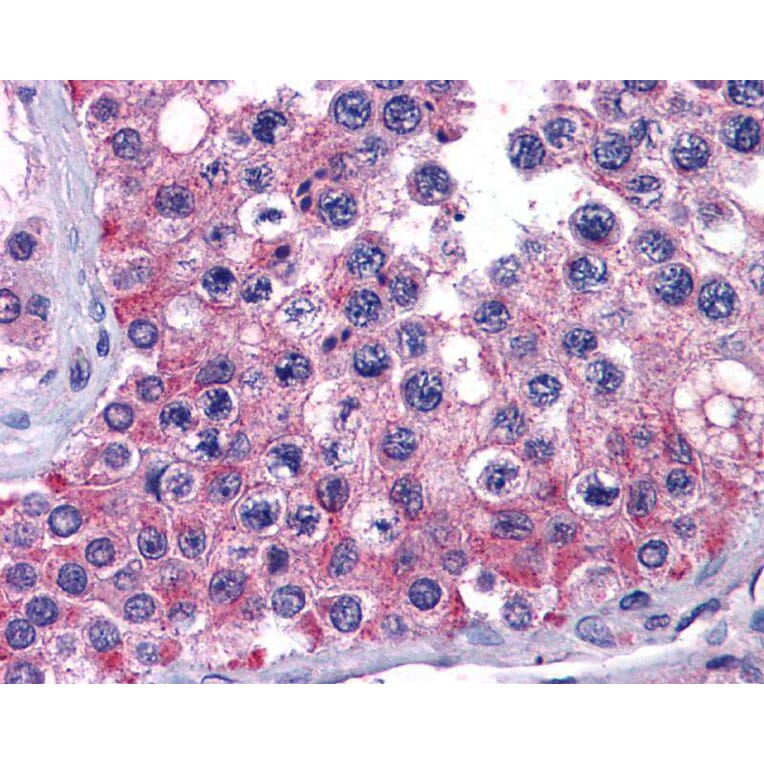 Immunohistochemistry - MIA3 antibody from Signalway Antibody (23183) - Antibodies.com
