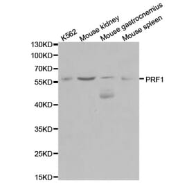 Western blot - PRF1 Antibody from Signalway Antibody (32003) - Antibodies.com