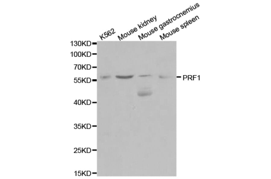 Western blot - PRF1 Antibody from Signalway Antibody (32003) - Antibodies.com