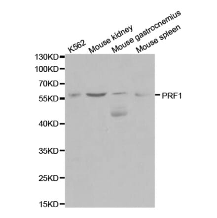 Western blot - PRF1 Antibody from Signalway Antibody (32003) - Antibodies.com