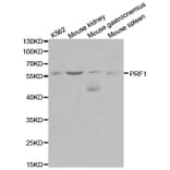Western blot - PRF1 Antibody from Signalway Antibody (32003) - Antibodies.com