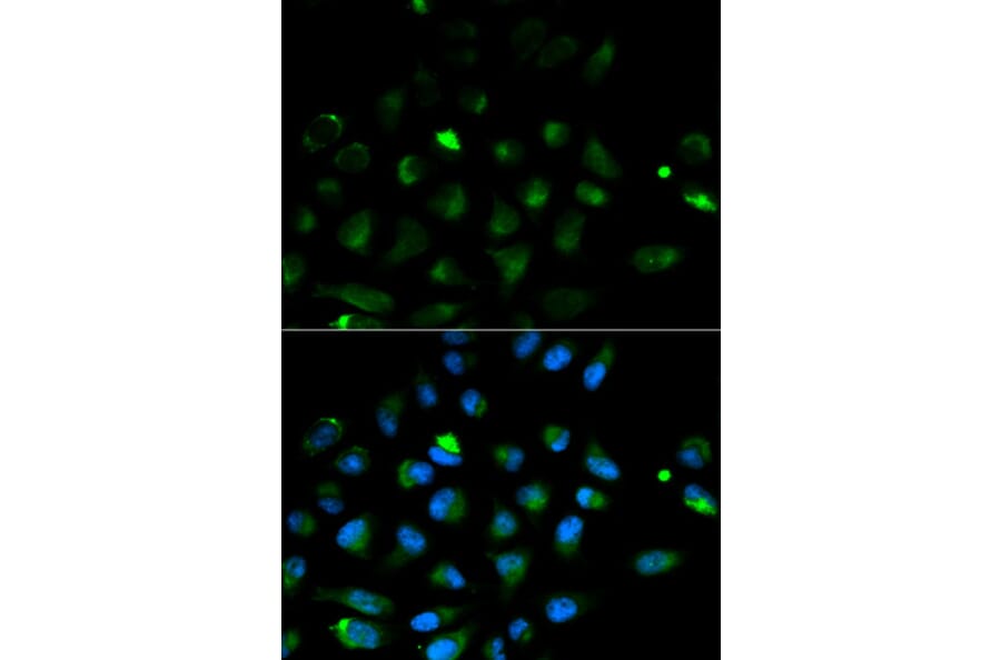 Immunofluorescence - PRF1 Antibody from Signalway Antibody (32003) - Antibodies.com