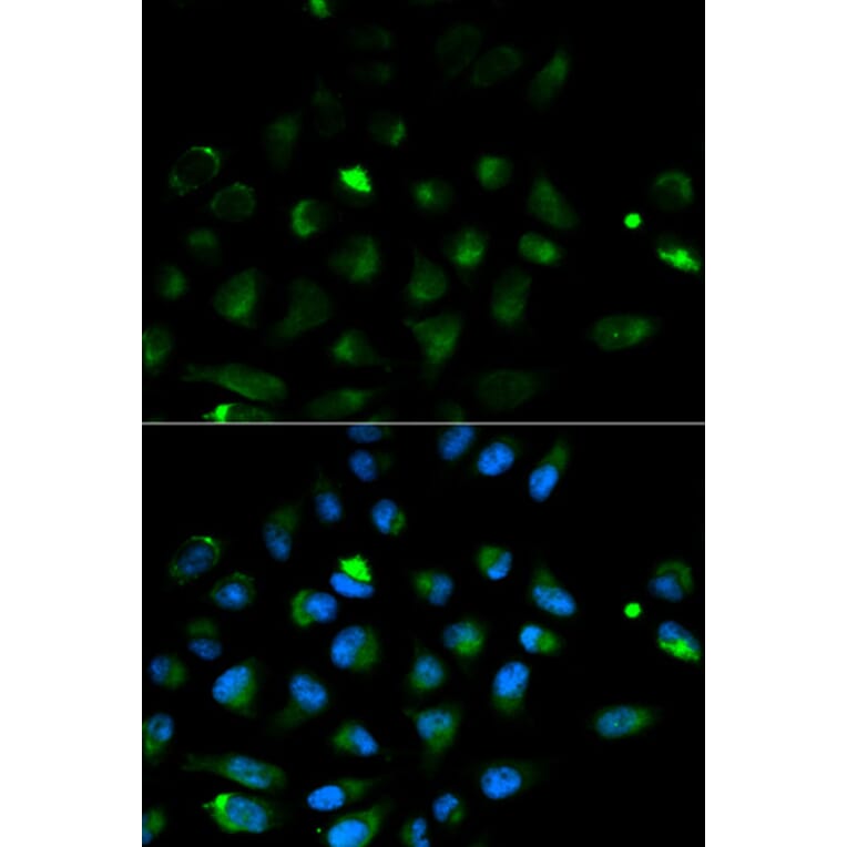 Immunofluorescence - PRF1 Antibody from Signalway Antibody (32003) - Antibodies.com