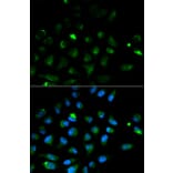 Immunofluorescence - PRF1 Antibody from Signalway Antibody (32003) - Antibodies.com