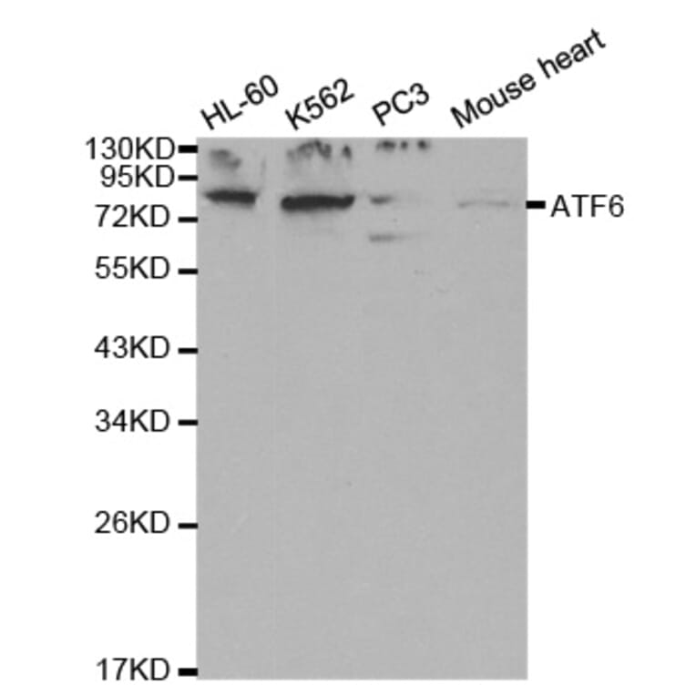 Western blot - ATF6 Antibody from Signalway Antibody (32008) - Antibodies.com