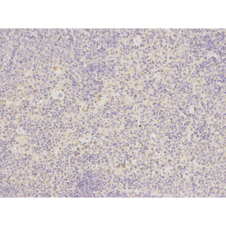 Immunohistochemistry - ATF6 Antibody from Signalway Antibody (32008) - Antibodies.com