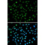 Immunofluorescence - ATF6 Antibody from Signalway Antibody (32008) - Antibodies.com