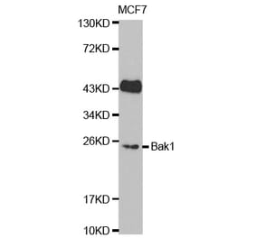 Western blot - BAK1 Antibody from Signalway Antibody (32009) - Antibodies.com