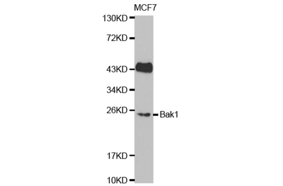 Western blot - BAK1 Antibody from Signalway Antibody (32009) - Antibodies.com