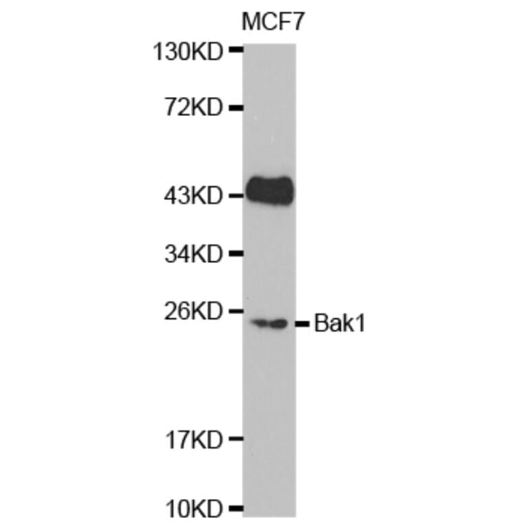 Western blot - BAK1 Antibody from Signalway Antibody (32009) - Antibodies.com