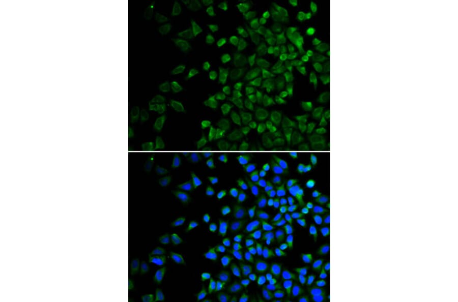 Immunofluorescence - BAK1 Antibody from Signalway Antibody (32009) - Antibodies.com