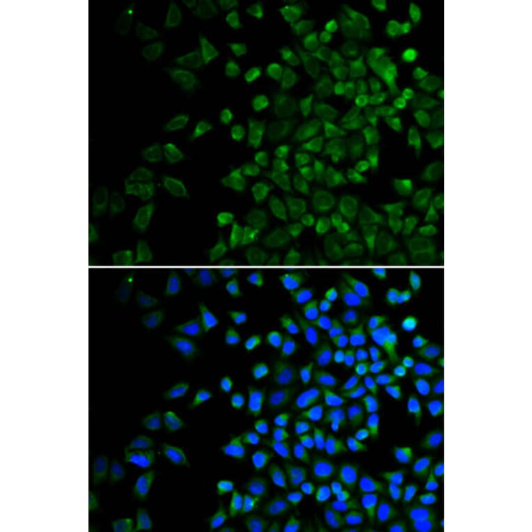 Immunofluorescence - BAK1 Antibody from Signalway Antibody (32009) - Antibodies.com