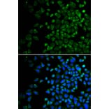 Immunofluorescence - BAK1 Antibody from Signalway Antibody (32009) - Antibodies.com