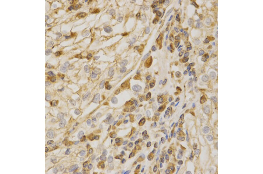 Immunohistochemistry - BAK1 Antibody from Signalway Antibody (32009) - Antibodies.com