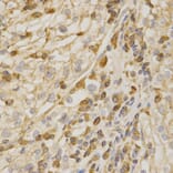 Immunohistochemistry - BAK1 Antibody from Signalway Antibody (32009) - Antibodies.com