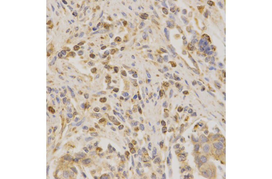 Immunohistochemistry - BAK1 Antibody from Signalway Antibody (32009) - Antibodies.com
