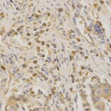 Immunohistochemistry - BAK1 Antibody from Signalway Antibody (32009) - Antibodies.com