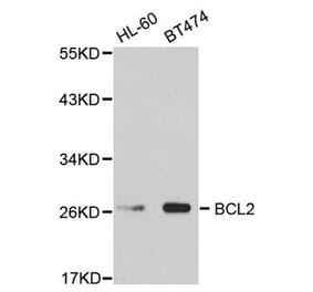 Western blot - BCL2 Antibody from Signalway Antibody (32012) - Antibodies.com