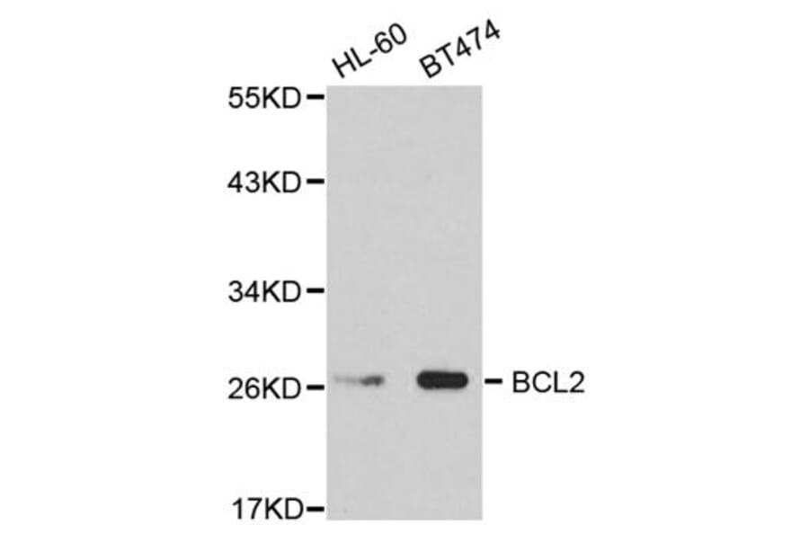 Western blot - BCL2 Antibody from Signalway Antibody (32012) - Antibodies.com