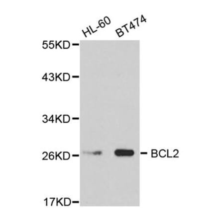 Western blot - BCL2 Antibody from Signalway Antibody (32012) - Antibodies.com