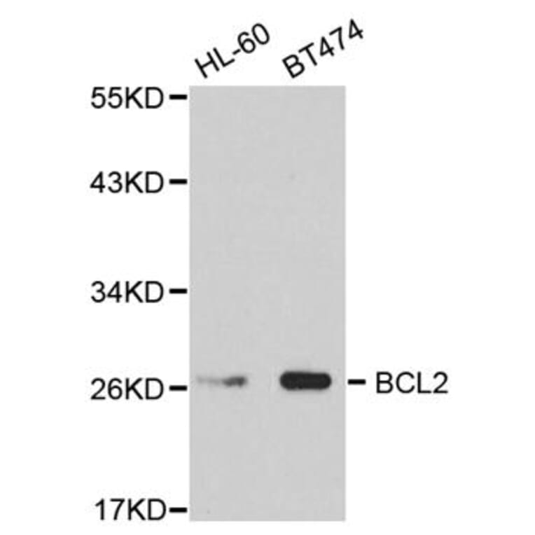 Western blot - BCL2 Antibody from Signalway Antibody (32012) - Antibodies.com