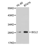 Western blot - BCL2 Antibody from Signalway Antibody (32012) - Antibodies.com