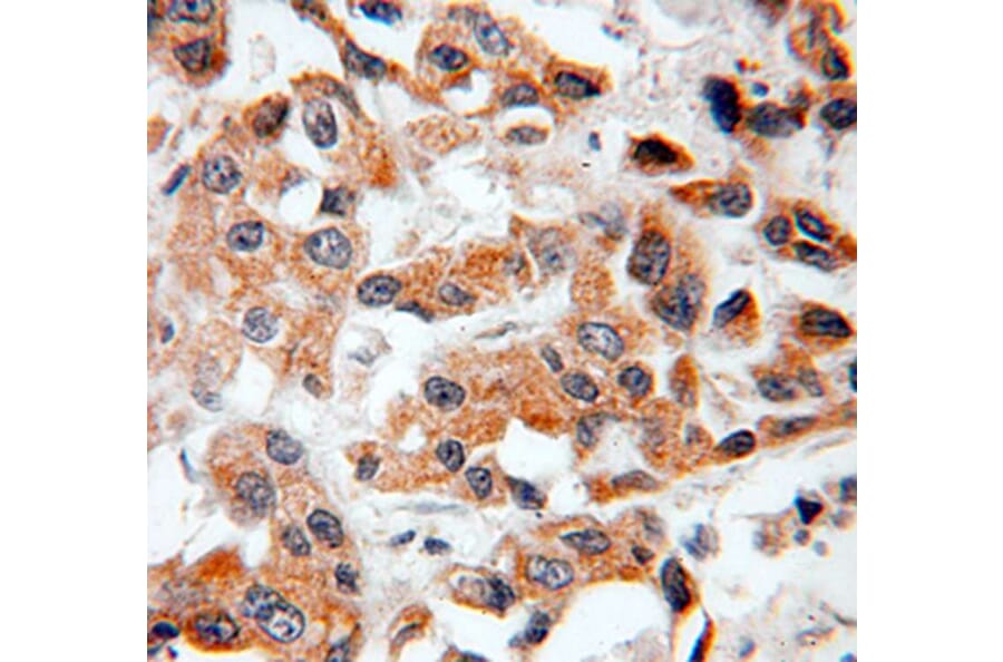 Immunohistochemistry - BCL2 Antibody from Signalway Antibody (32012) - Antibodies.com
