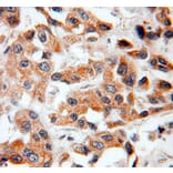 Immunohistochemistry - BCL2 Antibody from Signalway Antibody (32012) - Antibodies.com