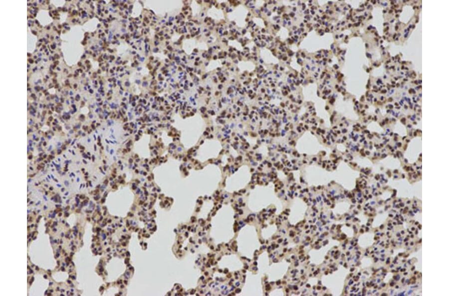 Immunohistochemistry - BCL2 Antibody from Signalway Antibody (32012) - Antibodies.com