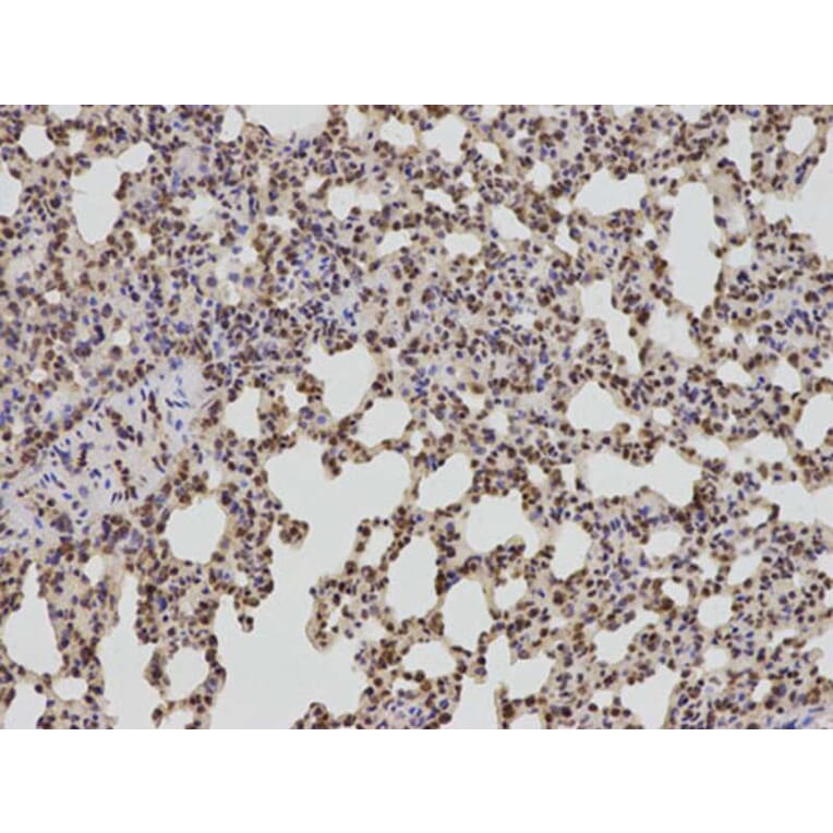 Immunohistochemistry - BCL2 Antibody from Signalway Antibody (32012) - Antibodies.com