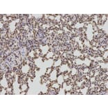 Immunohistochemistry - BCL2 Antibody from Signalway Antibody (32012) - Antibodies.com