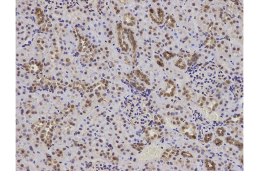 Immunohistochemistry - BCL2 Antibody from Signalway Antibody (32012) - Antibodies.com