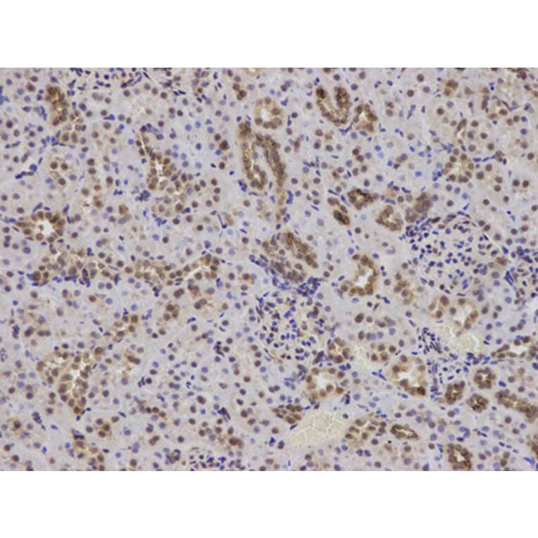 Immunohistochemistry - BCL2 Antibody from Signalway Antibody (32012) - Antibodies.com